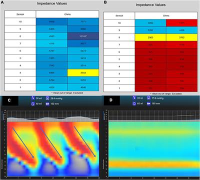 Novel Advances in the Evaluation and Treatment of Children With Symptoms of Gastroesophageal Reflux Disease